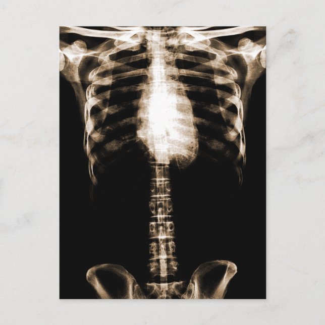 CARTÃO POSTAL XRAY SKELETON TORSO RIBS SEPIA (Frente)