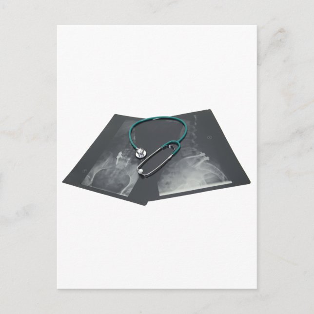Cartão Postal XRayConsult061209 (Frente)