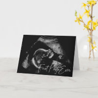 Primeira Foto de Chuvinha de Bebê por Ultrassom