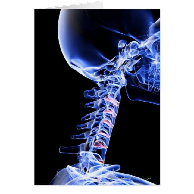 Cartão Radiografe a imagem dos ossos do pescoço (Frente)