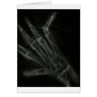 Cartão Raio X quebrado da mão