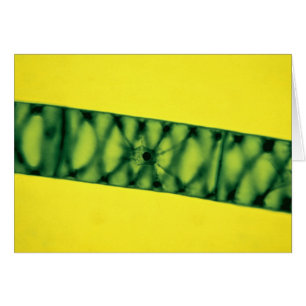 Cartão Spirogyra Green Algae