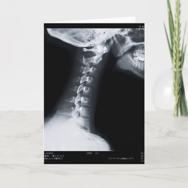 Cartão X ray of neck vertebrae including lower jaw (Frente)