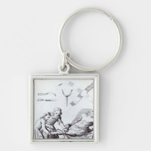 Chaveiro Operação cirúrgica para amputar um pé