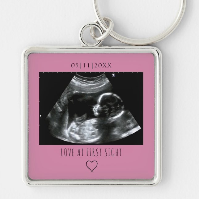 Chaveiro Sonogram Picture Photo Gift Baby Ultrasound Pink (Frente)
