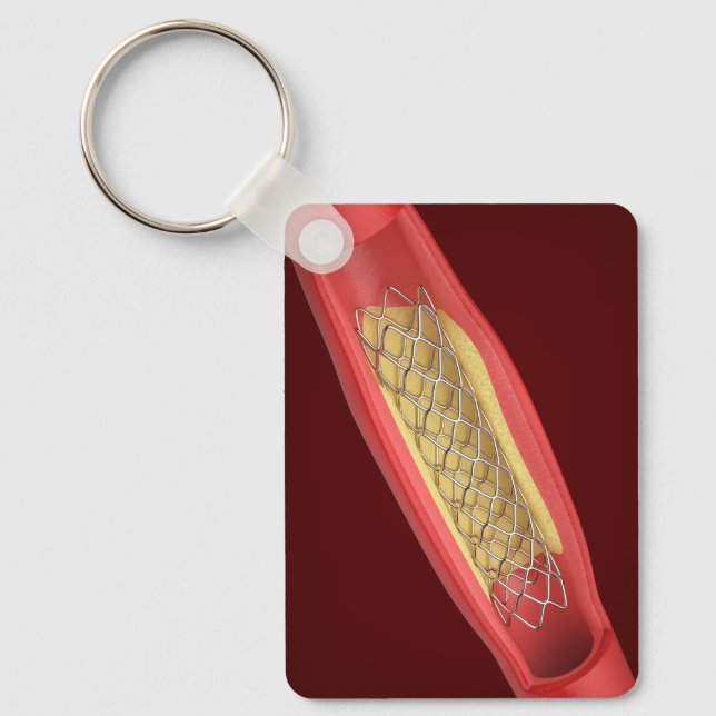 Chaveiro Stent médico dentro do vaso sanguíneo (Frente)