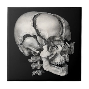 Ciência Vintage Anatomia Humana, Crânio Antigo