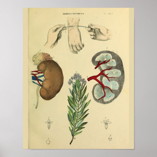 Cirurgia do pulso médico Rins Anatomia Impressão (Frente)