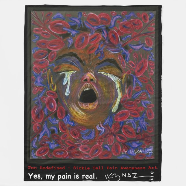 Cobertor De Velo 10 Redefinidos - Aberto de Fleece, (Frente)