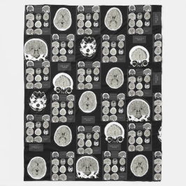 Cobertor De Velo CT Scan_this é depression_BLK_CTFOD