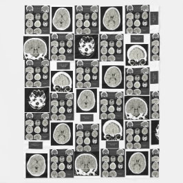 Cobertor De Velo CT Scan_this é depression_CTFOD
