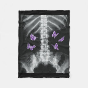 Cobertor De Velo Egirl Xray Skeleton Pink Butterfly Harajuku Y2k Da