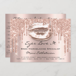 Convite Beijo Spark de Instrução de Retenção de Extensão L