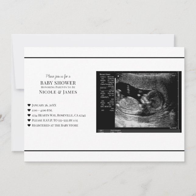 Convite Chá de Bebê Foto de Ultrassom Preto e Branco Minim (Frente)
