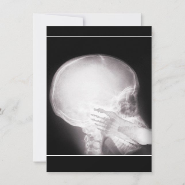 Convite de prescrição c/Foot In Mouth X-ray (Frente)