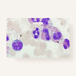 Crachá RBCs WBCs Slide Microscope Hematology Lab