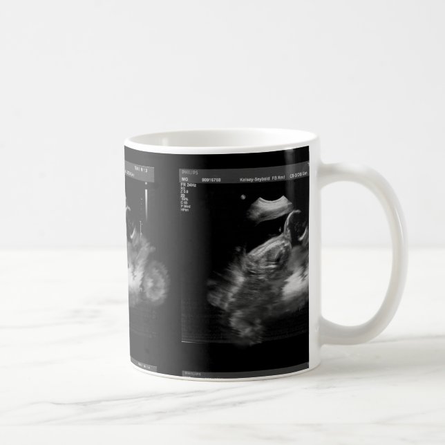 De Café Caneca do Sonogram da motocicleta (Direita)