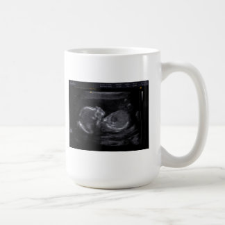 De Café Caneca personalizada do ultra-som