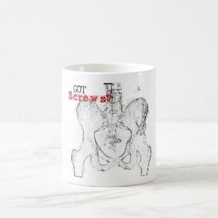 De Café Parafusos obtidos? Caneca