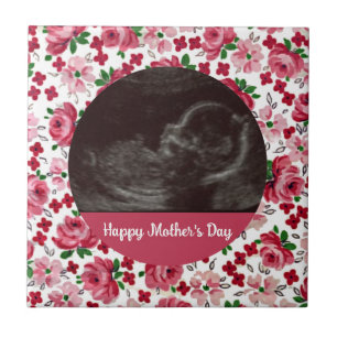 Dia de as mães de Ultrassom Personalizado de Rosa