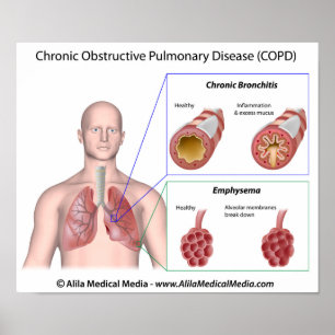 Doença pulmonar DPOC marcada com Poster