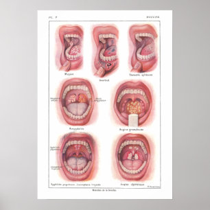 Doenças da anatomia da boca Poster francês