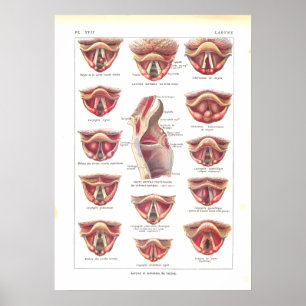Doenças do francês do poster da anatomia da