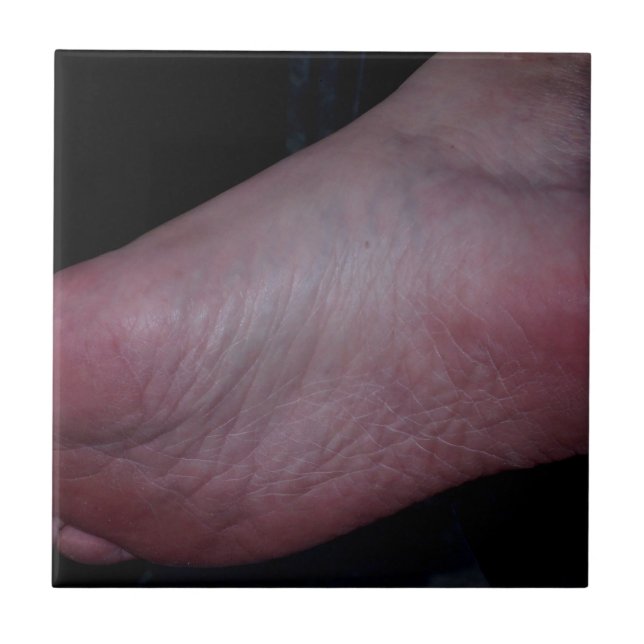 DOMÍNIO DO PÉ (Frente)