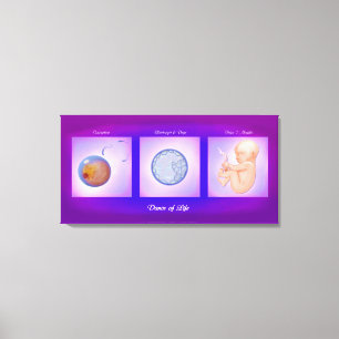 Em Tela Impressão De Telas De Arte De Gravidez Da Dança De