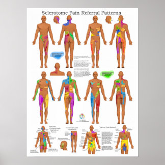 Esclerotoma Dor Conjunta Poster quiroprática