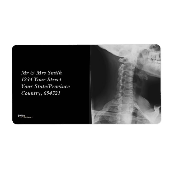 Etiqueta Raios X 2 (Frente)