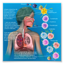 Alergias: IgE resposta inflamatória poster