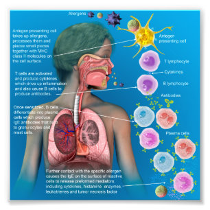 Foto Alergias: Poster inflamatório da resposta de IgE