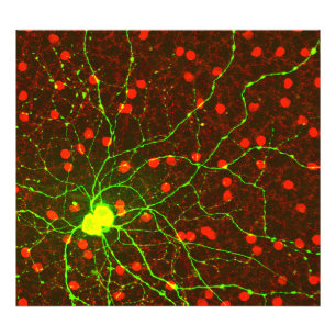 Foto Feche acima da ideia da pilha retina do gânglio