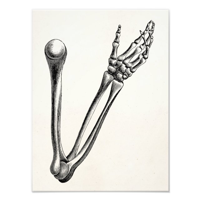 Foto Vintage Skeleton Arm Bone Personalizado Ossos Retr (Frente)