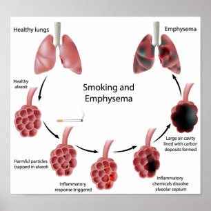 Fumante e Poster de enfisema