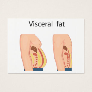 Gordura visceral