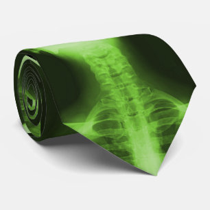 Gravata 2 radiografados - Verde radioativo