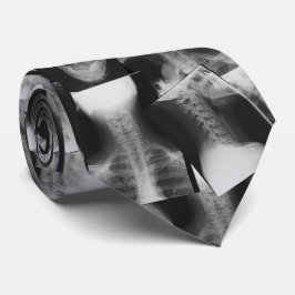 Gravata Rastreado por X