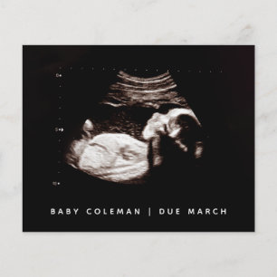 Gravidez Orçamento Sonograma de bebê Ultrassom F