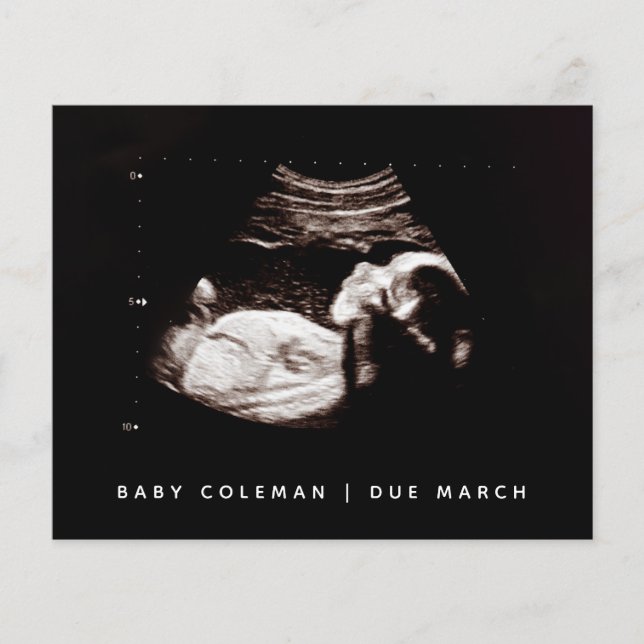 Gravidez Orçamento Sonograma de bebê Ultrassom Fot (Frente)