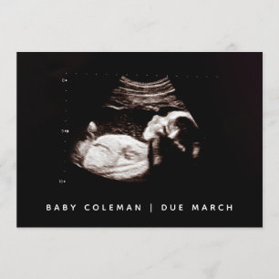 Gravidez Sonograma de bebê Cartão com fotos de u