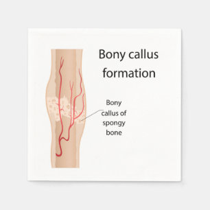 Guardanapo De Papel Formação de Bony Callus