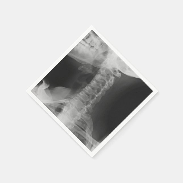Guardanapo De Papel X-Rayed 2 (Original) (Canto)