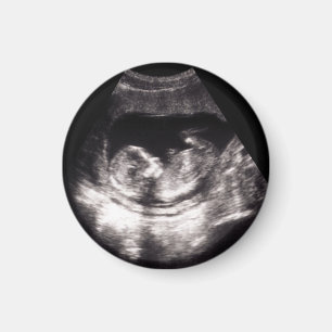 Imã Anúncio de gravidez de ultrassom personalizado par
