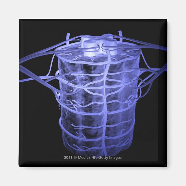 Imã Artérias que circundam parte da coluna vertebral (Frente)