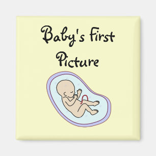 Imã Ímã do "Sonogram"