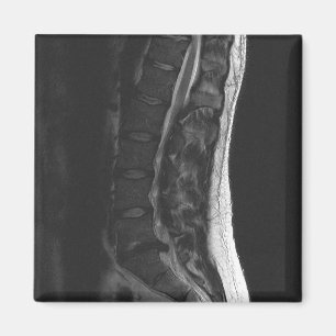 Imã Ímã rompido do disco