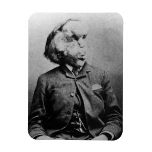 Ímã Joseph "John" Merrick Elephant Man desde 1889