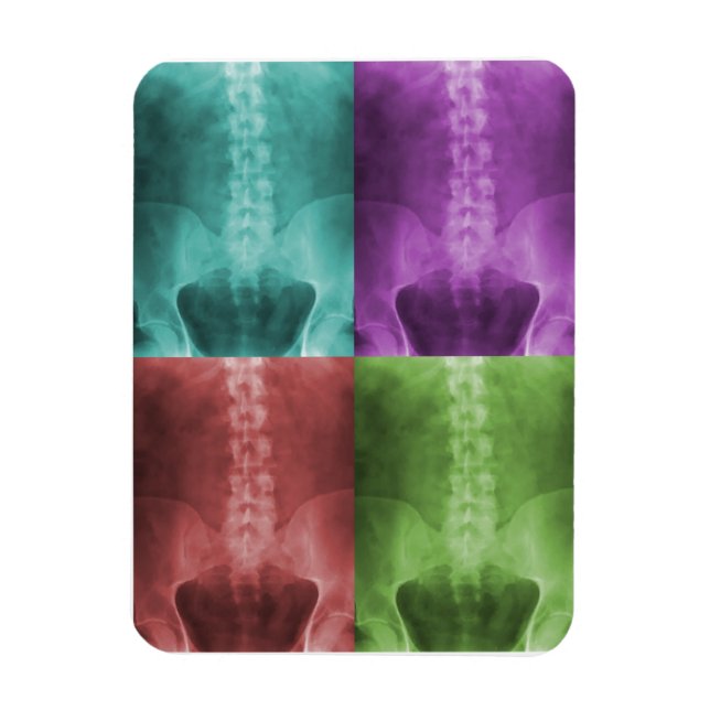 Ímã Magnet Digital X-Ray Art Premium (Vertical)